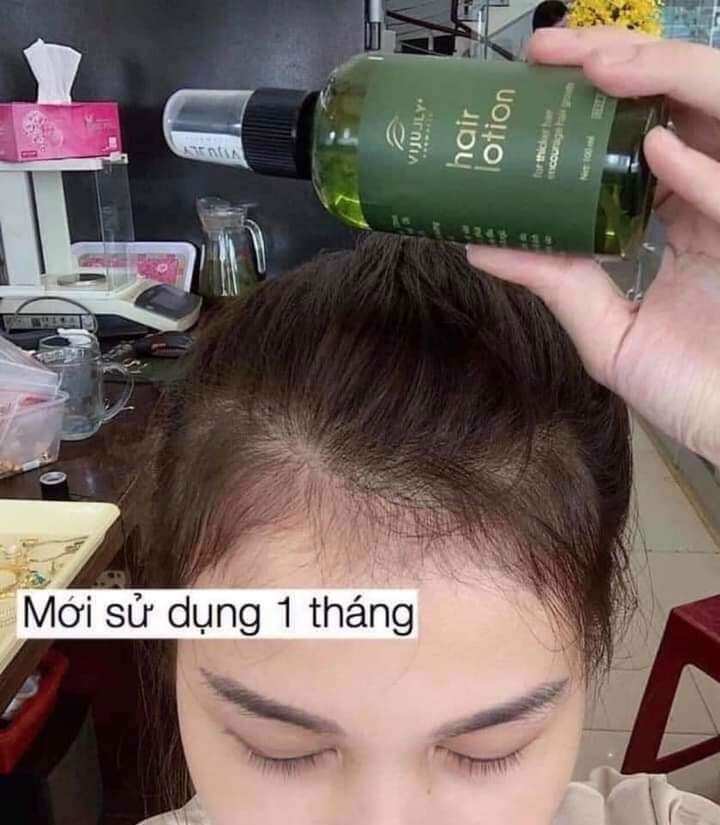 (Mẫu mới) Xịt tóc tinh dầu bưởi vijully. kích thích mọc tóc, giảm rụng tóc