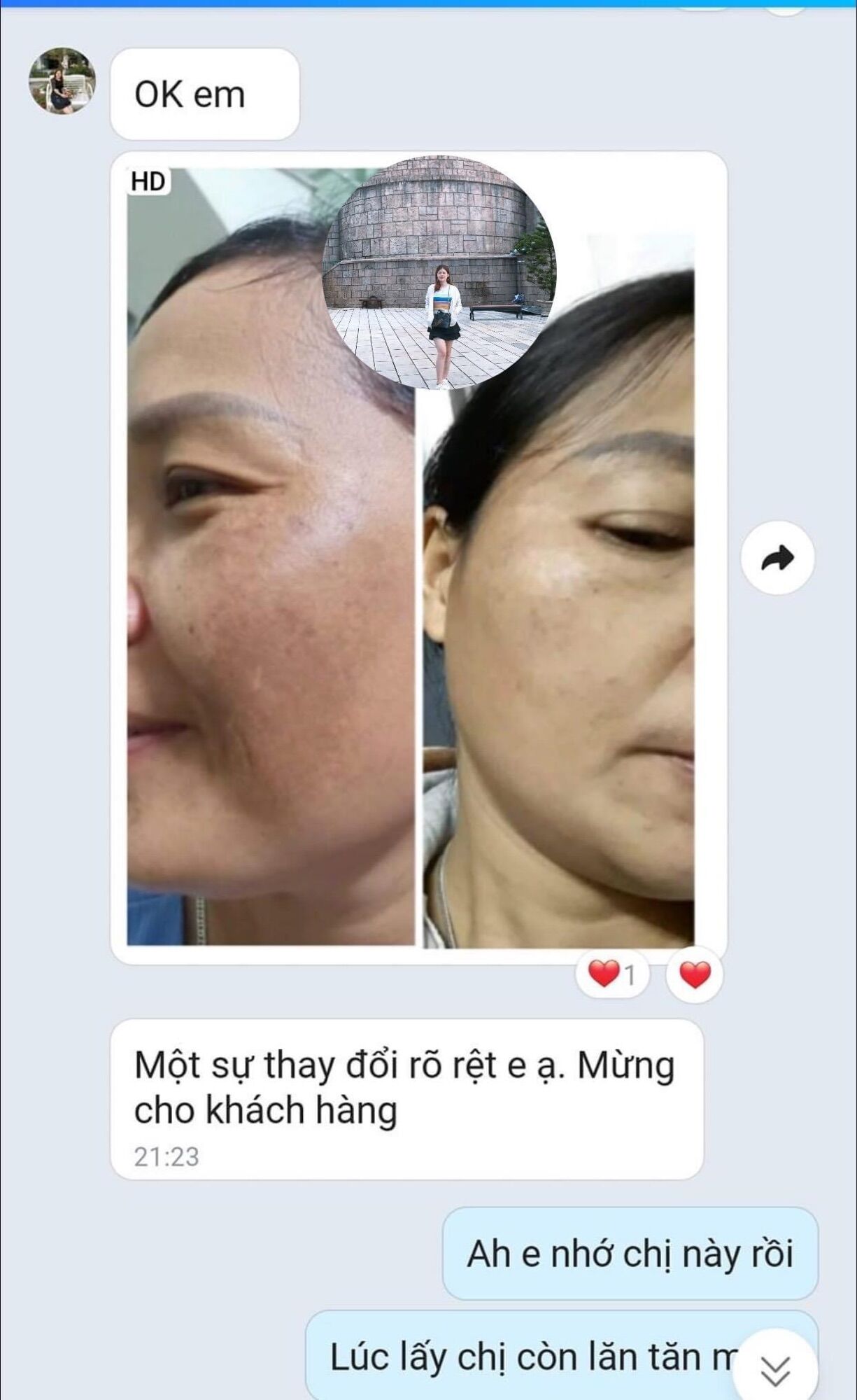 VUA NÁM NGHỆ COLLAGEN BAN NGÀY