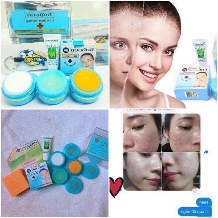 KEM TRỊ MỤN YANHEE XANH