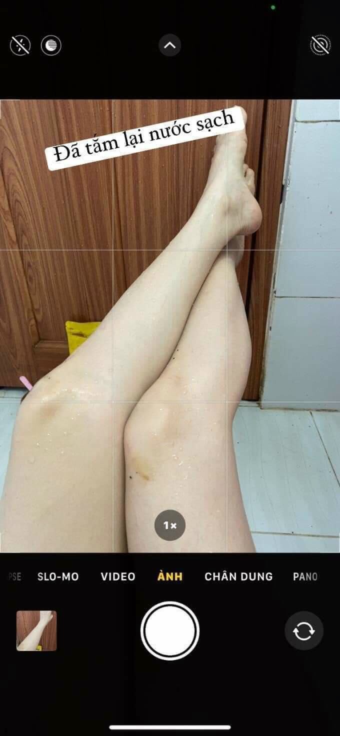 Tắm Trắng Da Toàn Thân