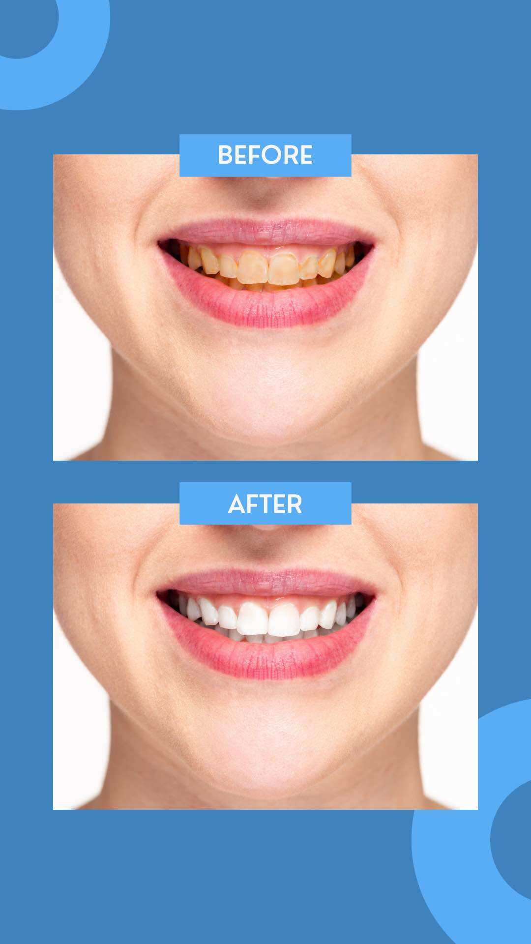 Tinh dầu răng miệng DB Dental Care [ CHÍNH HÃNG].