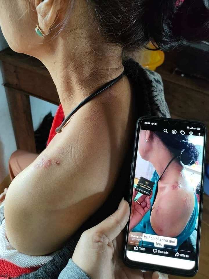 thảo mộc bôi da