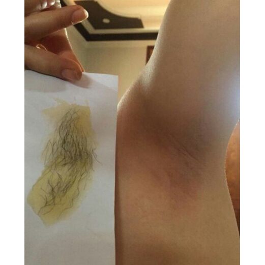 [HCM] Wax lông, triệt lông tại nhà - wax Shiny