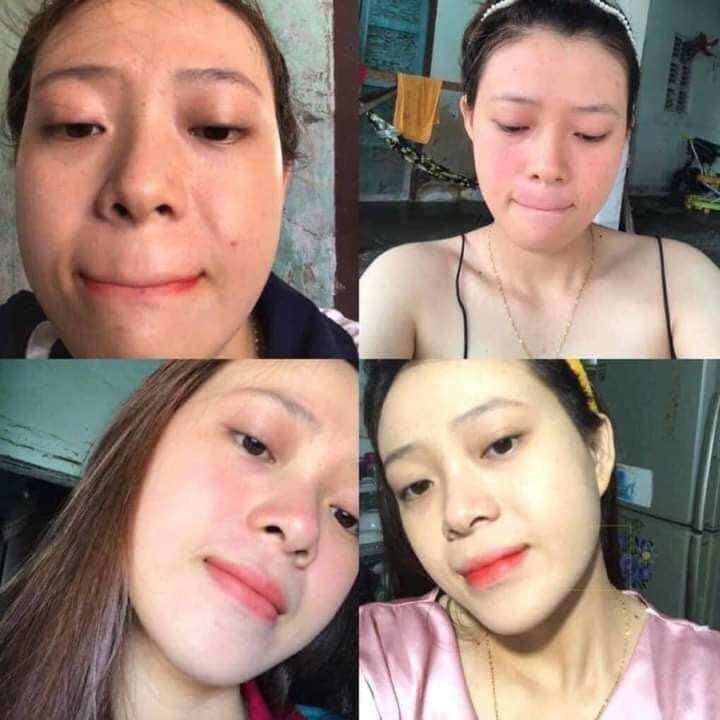 Bột rửa mặt thuốc bắc