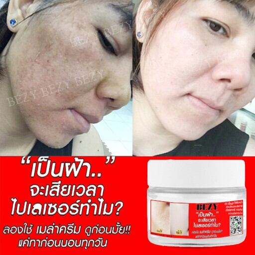Kem Bong Da Tái Tạo Mờ Nám Sạm Bezy