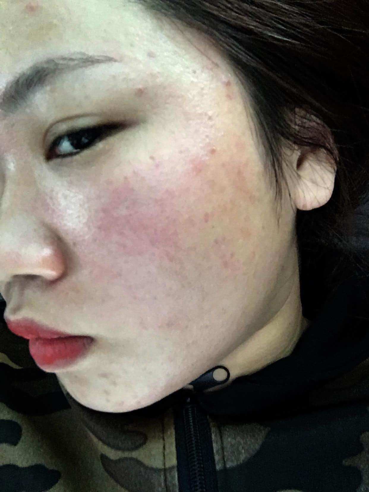 Thuốc bắc tái tạo da ( chính hãng)lẻ = sỉ