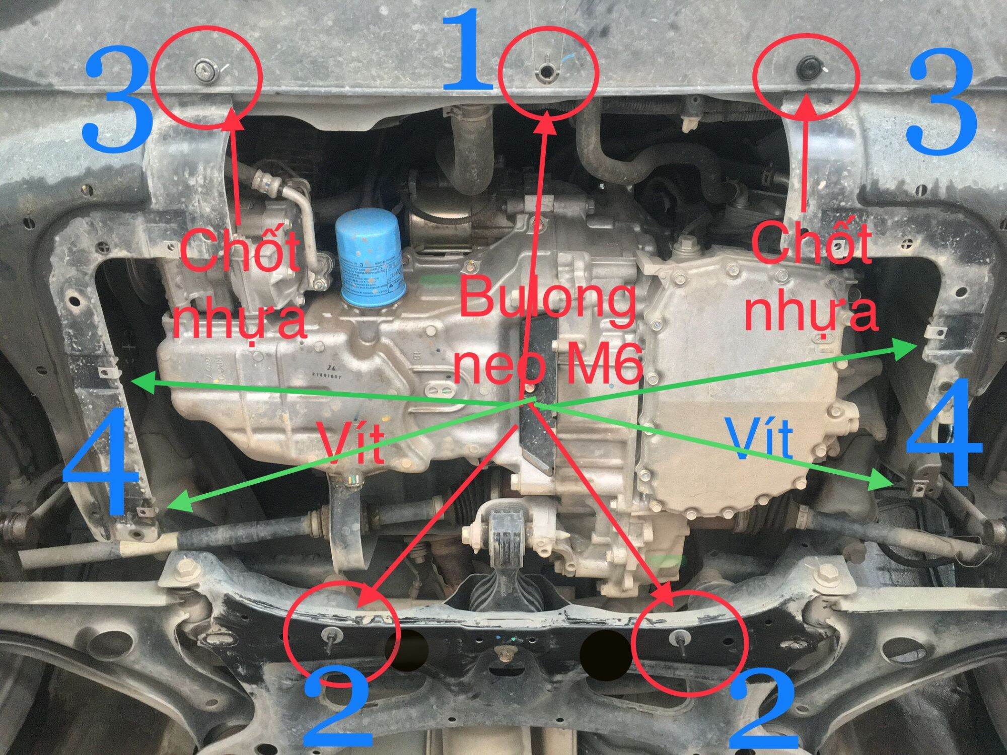 Chắn bùn gầm động cơ Honda City 2015-2020; 2021-2024