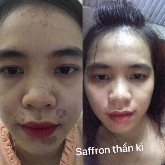 Tinh Chất  Sâm Đất Saffron  DR CELL 20ml
