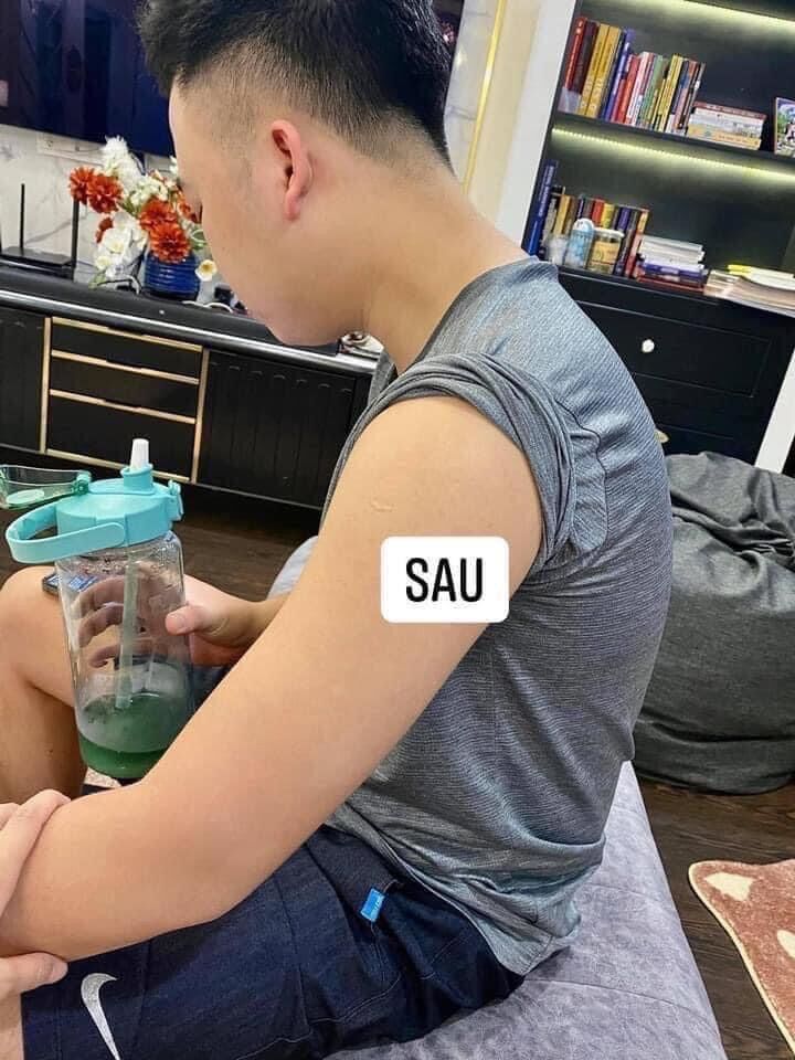 kela viêm nang lông 60ml thái lan