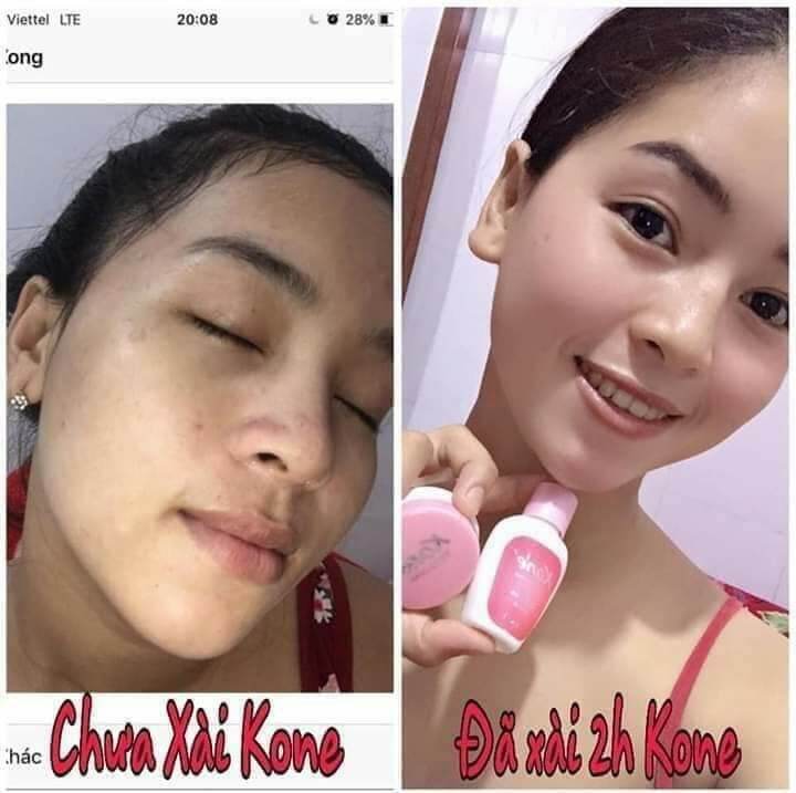 kem koné Thái Lan chính hãng 💯