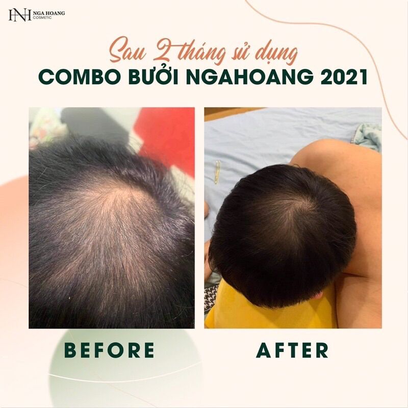 [HCM]Tinh dầu bưởi xịt tóc Hoàng Cầm mẫu mới