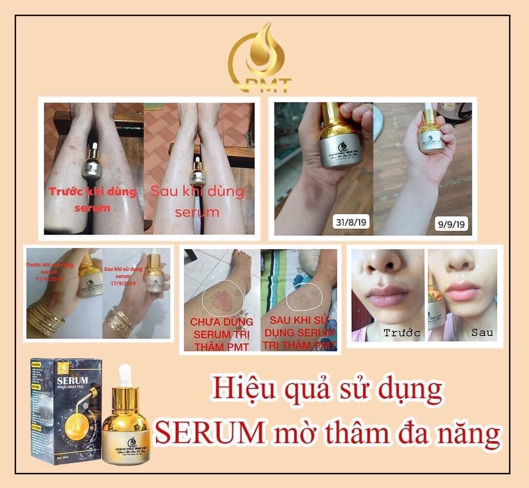 Serum thâm phúc minh tâm