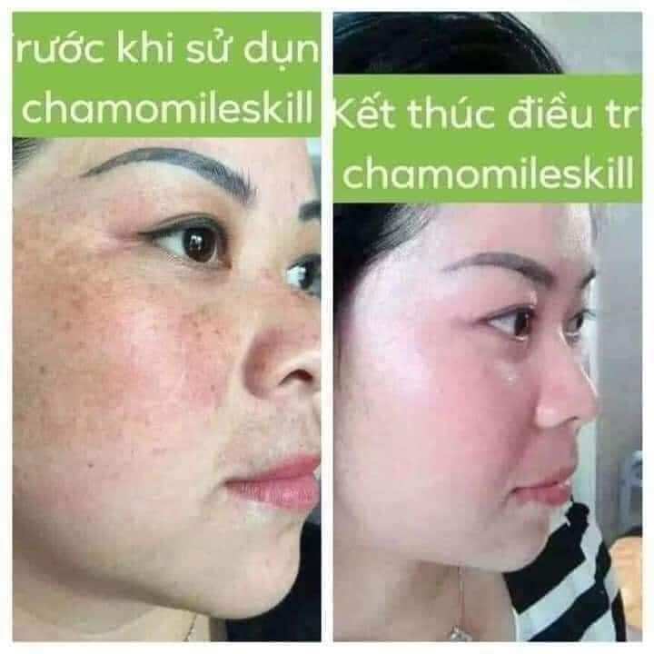 Kem tái tạo vàng Chamomile skill