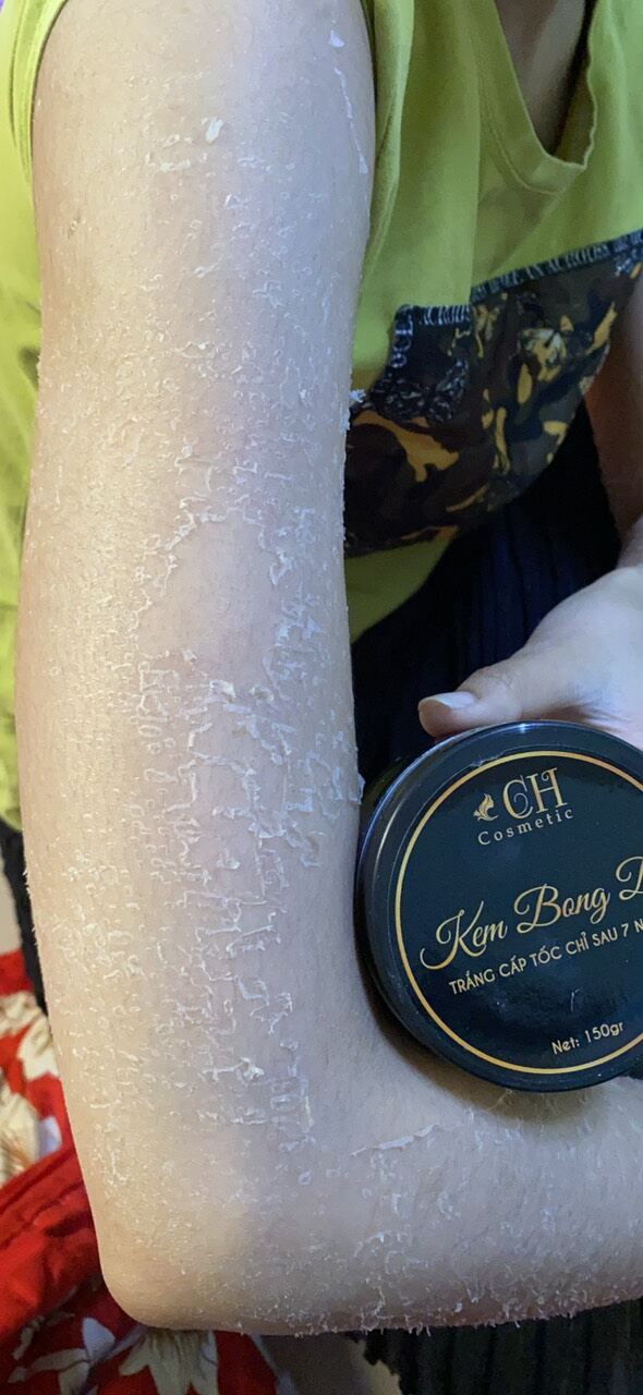 kem bong da - kem tái tạo da body