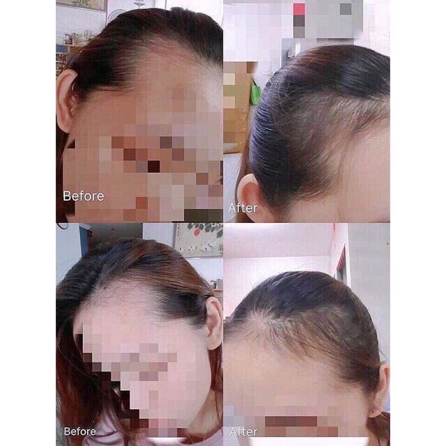 Tinh chất mọc tóc sato JG nhật bản