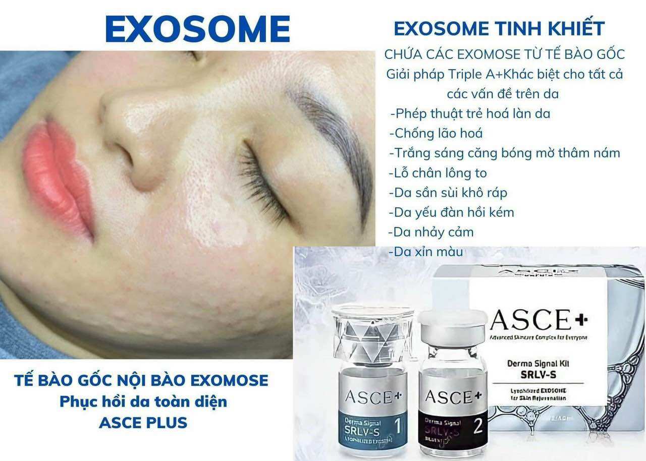 Asce plus exosome mẫu mới 2024 full tem mã check qr
