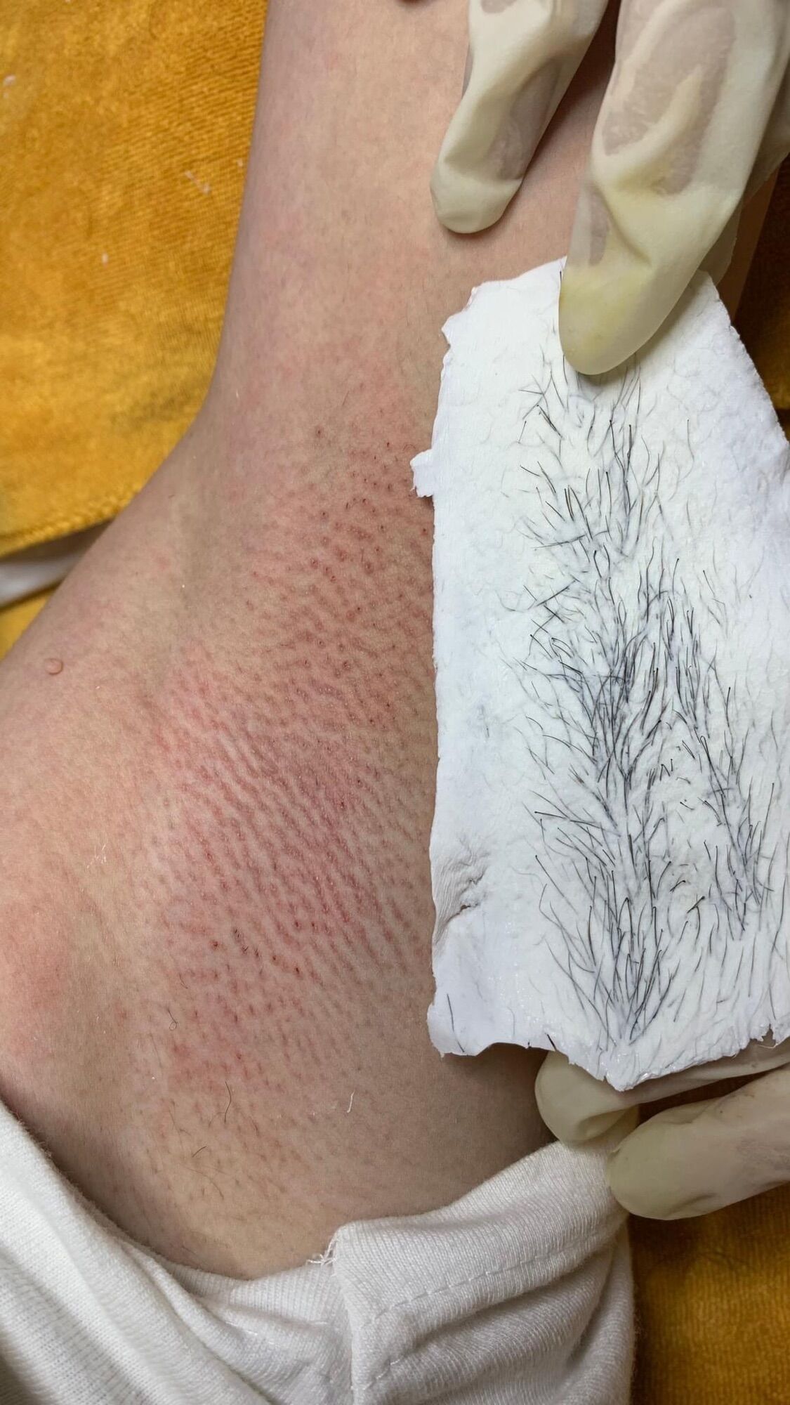 COMBO WAX LÔNG 99K 100G SÁP , CHÉN SILICON, SERUM MỠ
