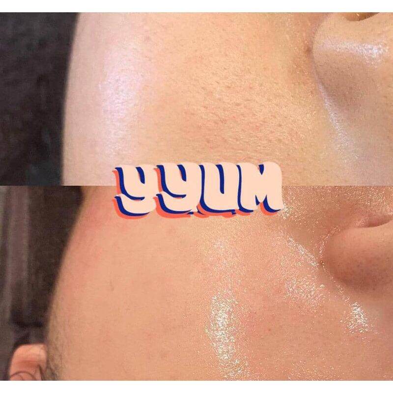 Serum phục hồi da B5 Oxygen Ceuticals Hàn Quốc 30ml & 60ml