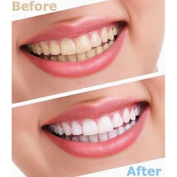 [Bill Mỹ]Kem đánh răng Crest Baking Soda & Peroxide Whitening 161g