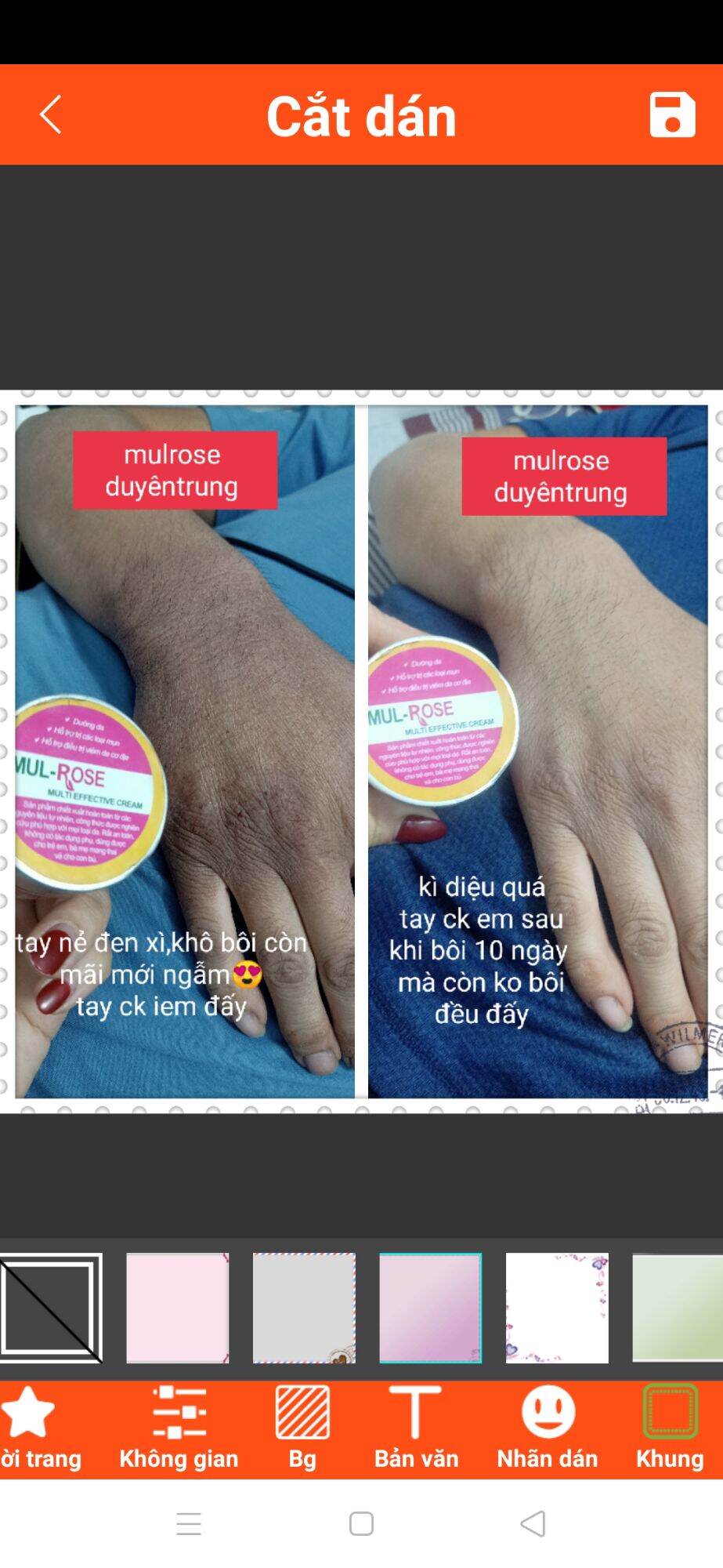kem nghệ mulrose +serum blackrose