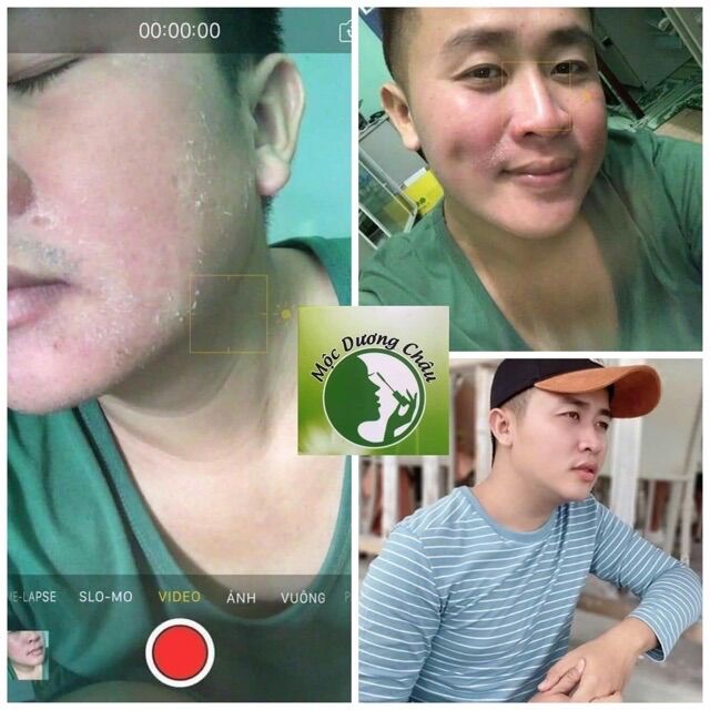 COMBO TÁI TẠO DA MỘC DƯƠNG CHÂU