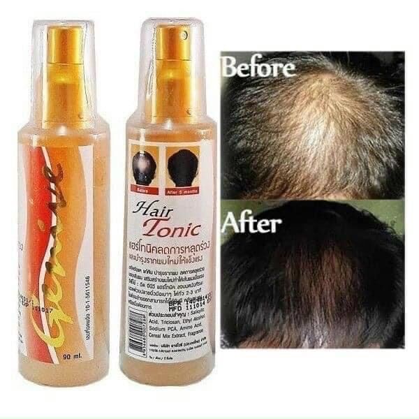 Chai xịt mọc tóc Genive Hair Tonic Thái Lan