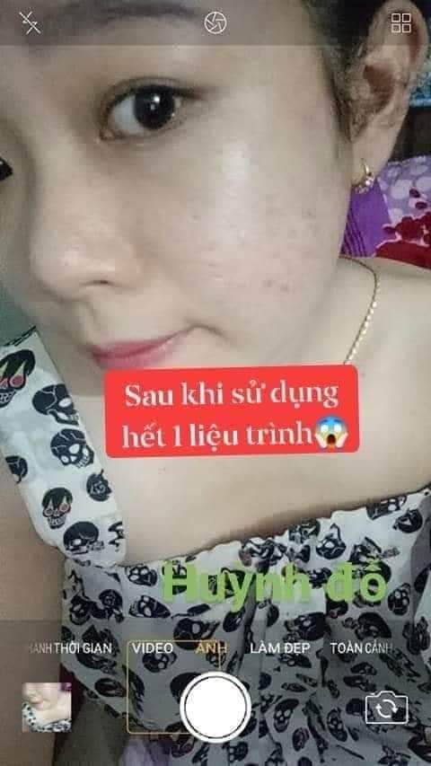 SỈ 2 HỘP FACE MỤN HUỲNH ĐỔ