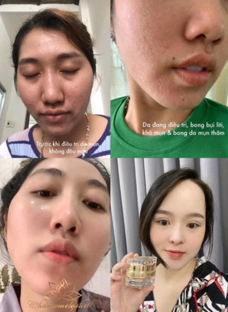 Kem tái tạo vàng Chamomile skill