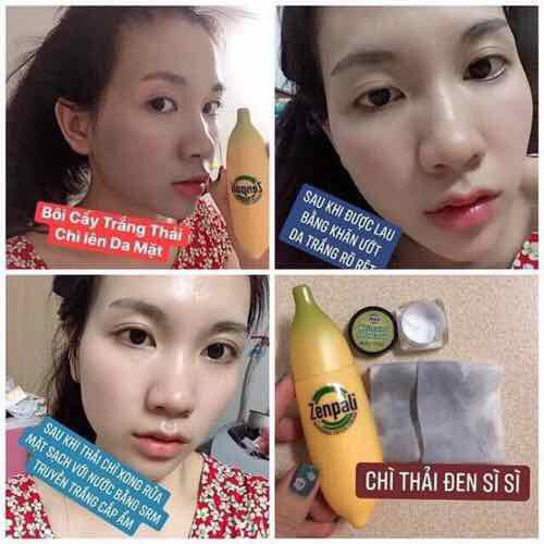 Chuối cấy trắng thải chì Zenpali