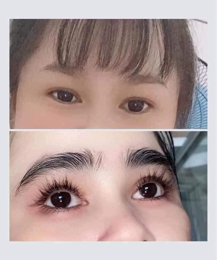 COMBO SERUM DÀI MI KÍCH MỌC MI DÀI VÀ DÀY