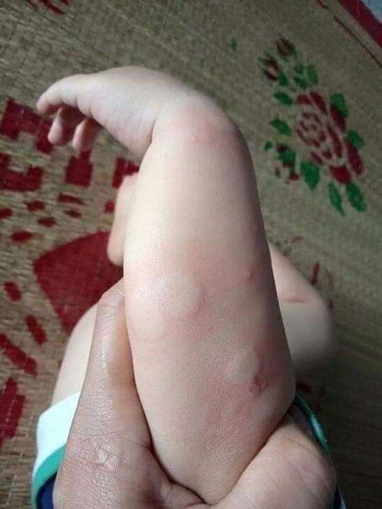 Cùi đèn đuổi muỗi