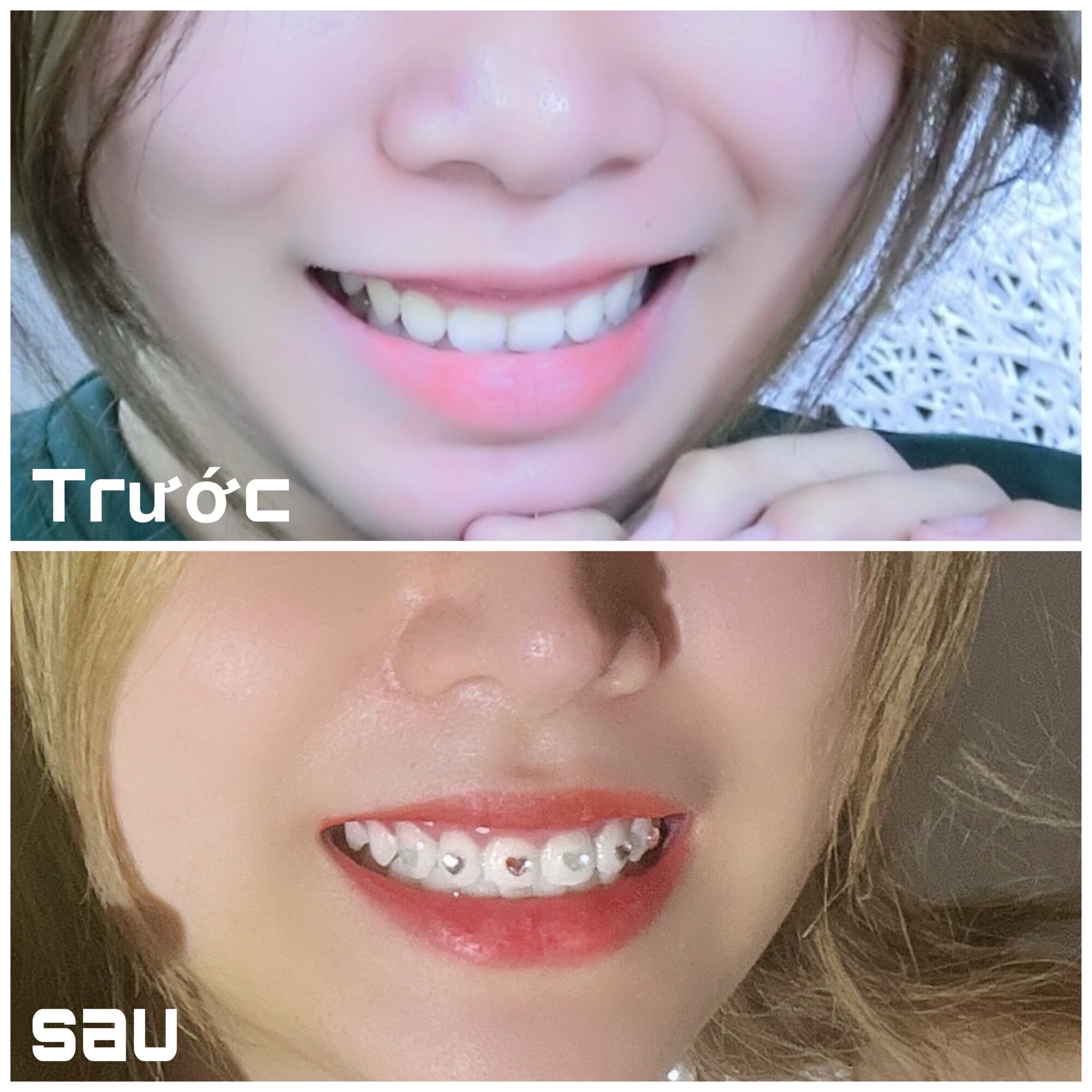 MIMI TEETH WHITENING PEN - BÚT TẨY TRẮNG RĂNG