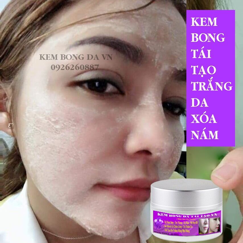 Kem bong nám sạm tàn nhang trắng da tái tạo da vn