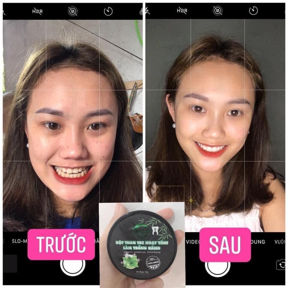 Bột Than Tre Hoạt Tính Trắng Răng Zenpali