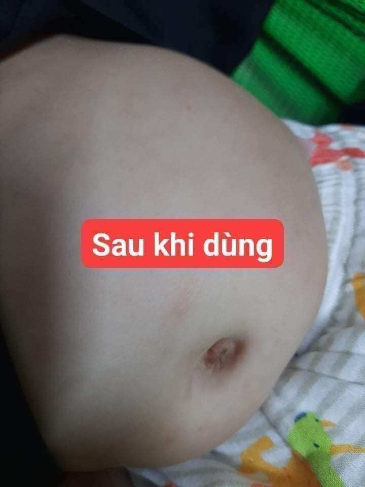 Sữa tắm gội Thảo dược Lợi An