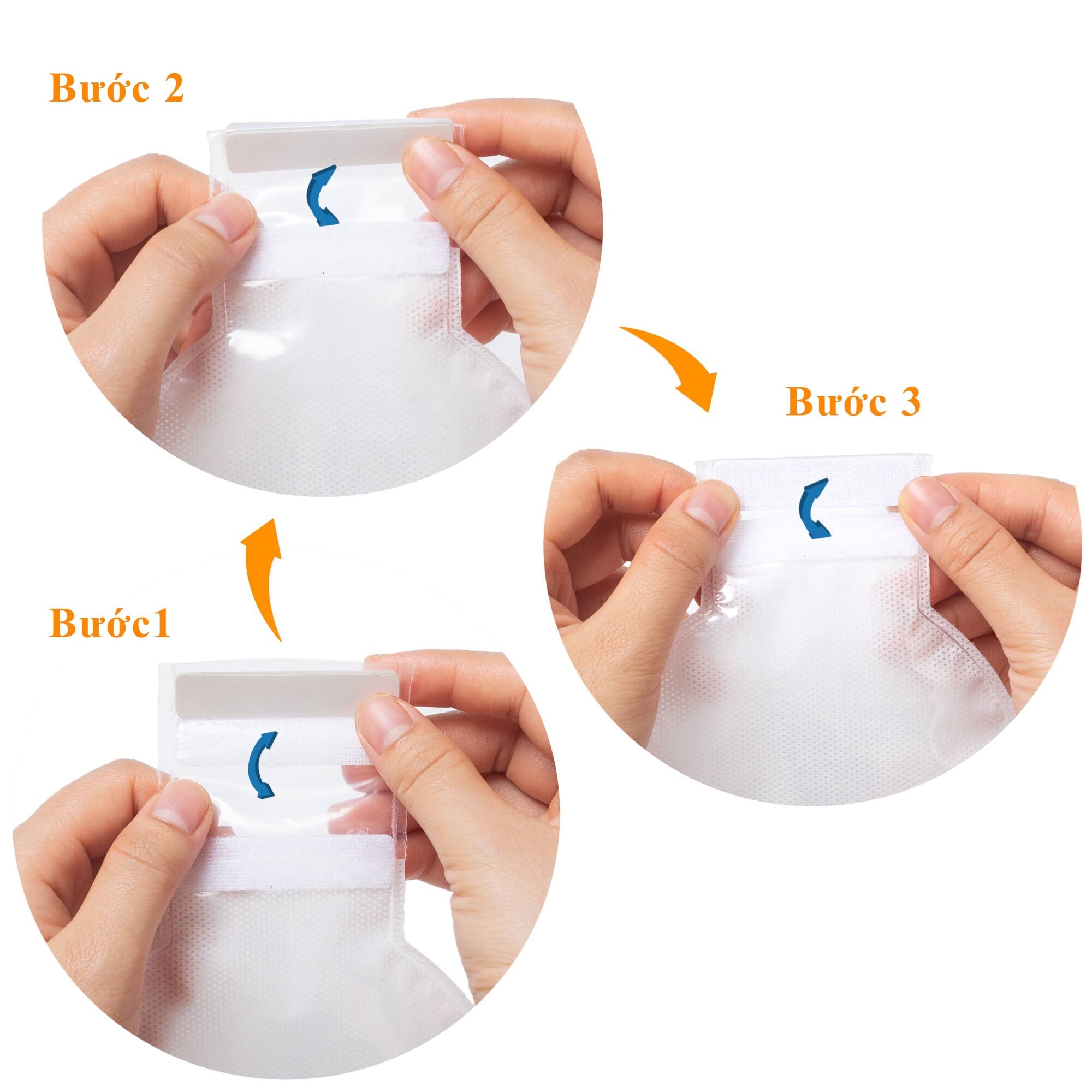 Túi hậu môn cho trẻ sơ sinh