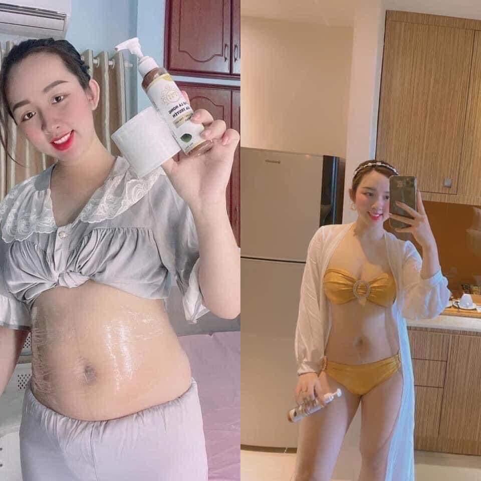 Cao lá nóng gia truyền ( giảm mỡ bắp tay- chân- đùi- bụng )