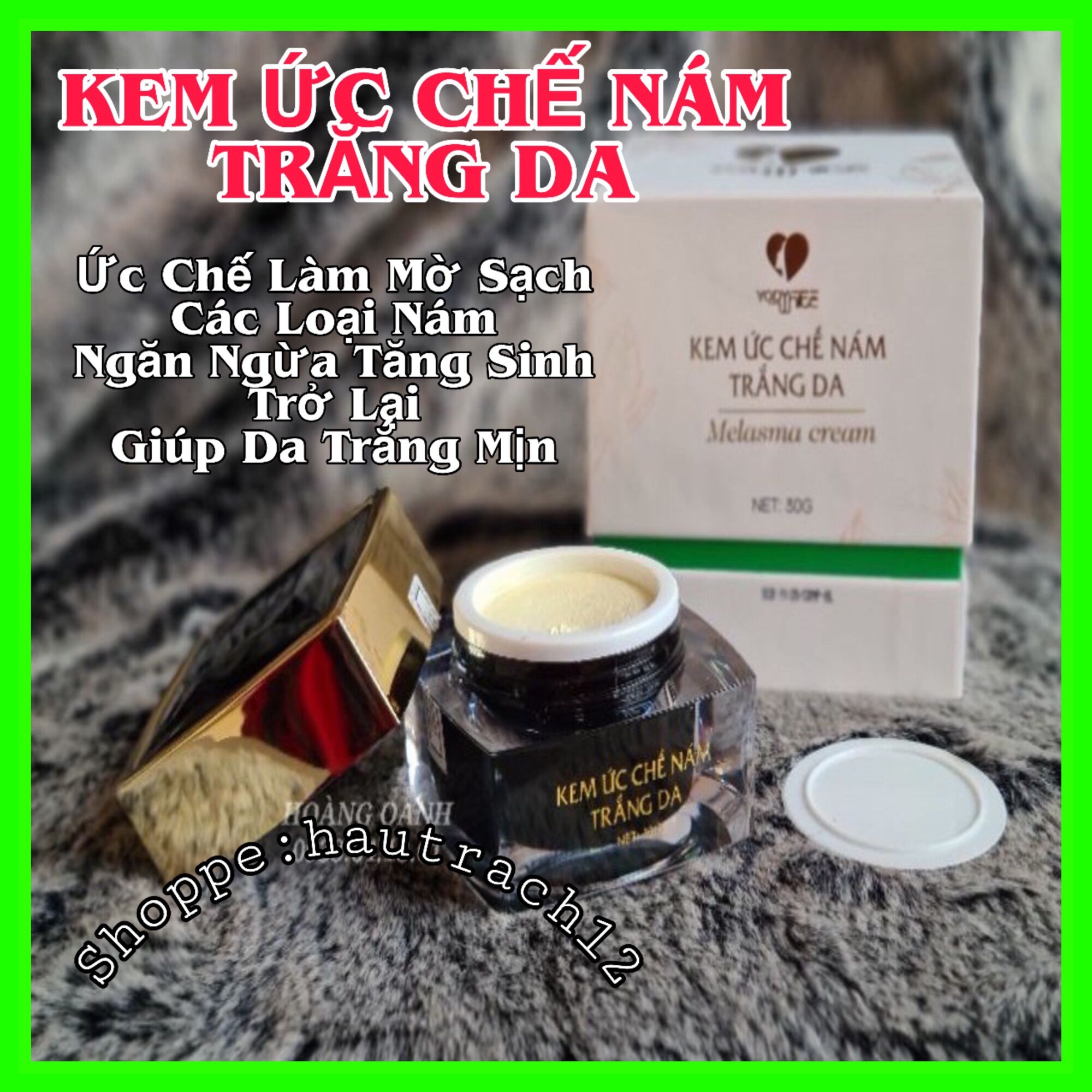 Kem Ức Chế Nám Trắng Da Yody White Phương Anh