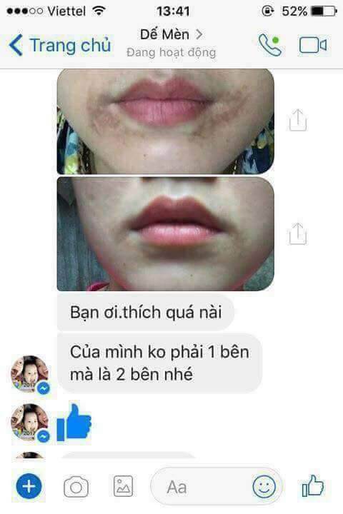 Tinh Dầu Cao Cấp Xoá Thâm Linh Hương
