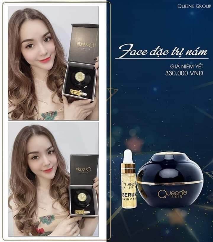 Kem tri nám queenie skin