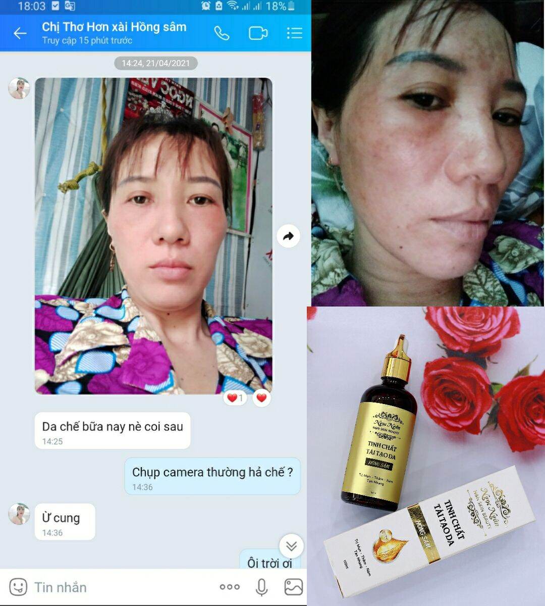 Combo Tái Tạo Hồng Sâm ( tinh chất hồng sâm + bột thảo dược rửa mặt)