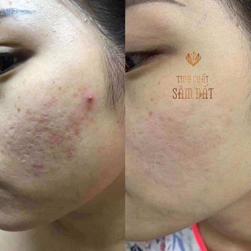 Tinh Chất Sâm Đất DR CELL 50ml