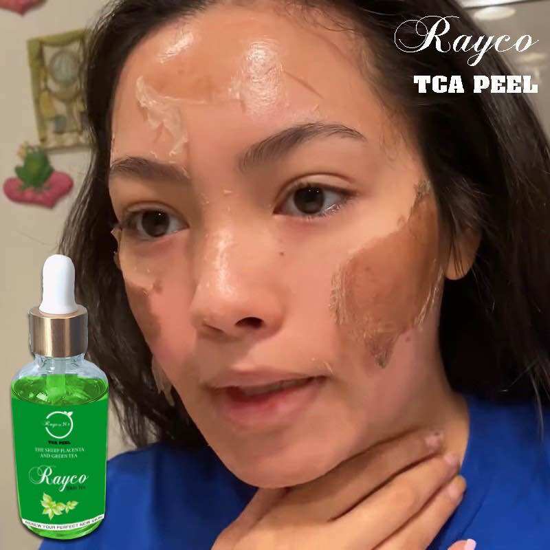 Peel bong mạnh tái tạo da