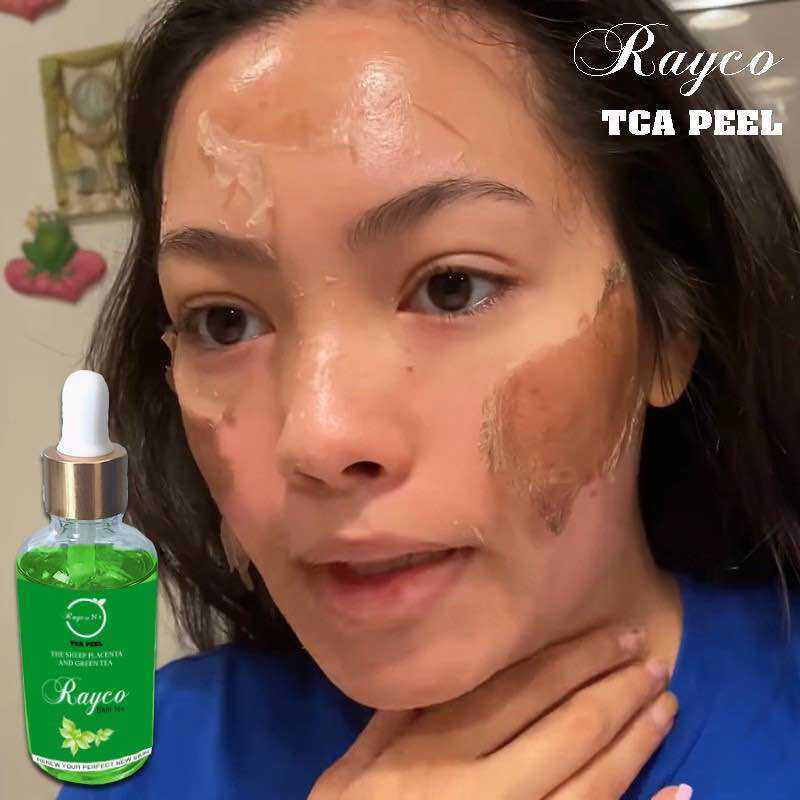 Peel Bong Mạnh Tái Tạo Da