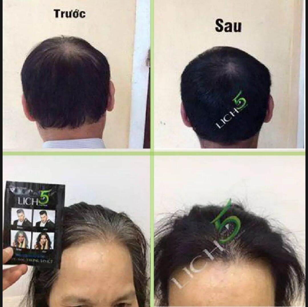 Dầu Gổi Đen Tóc Thảo Dược ( có 2 màu; màu đen và màu nâu đen)