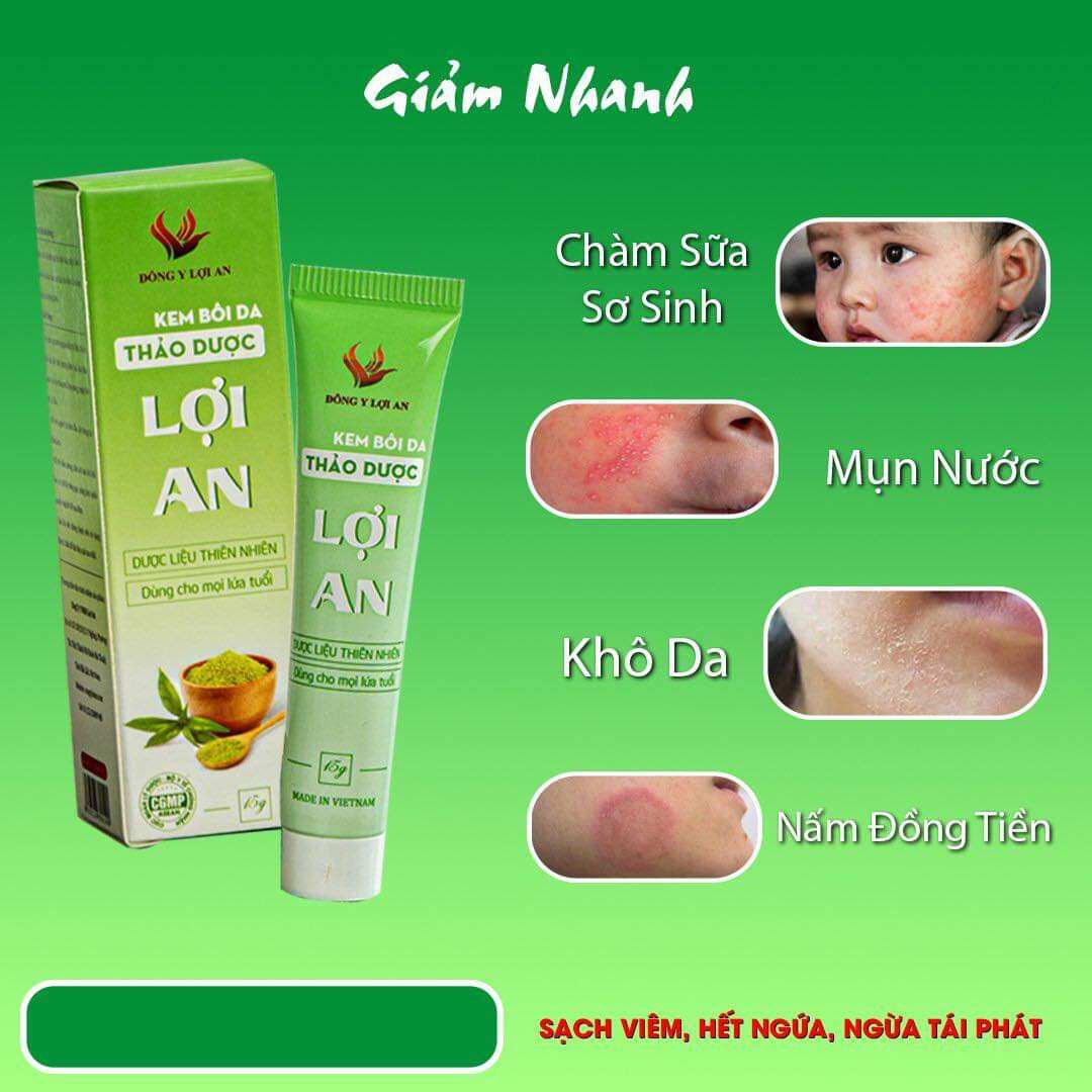 Kem bôi da Lợi An hết rôm sảy, chàm sữa,_hàng chuẩn