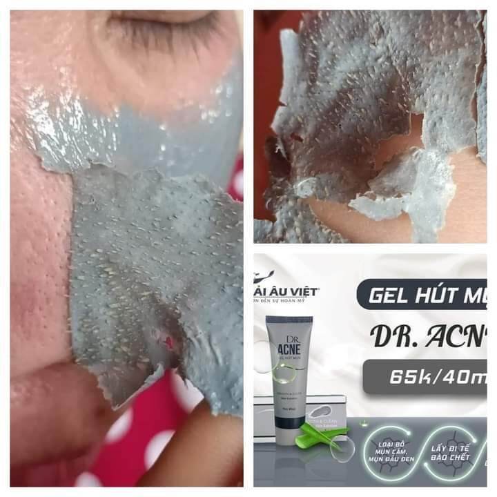 Gel hút mụn Dracne