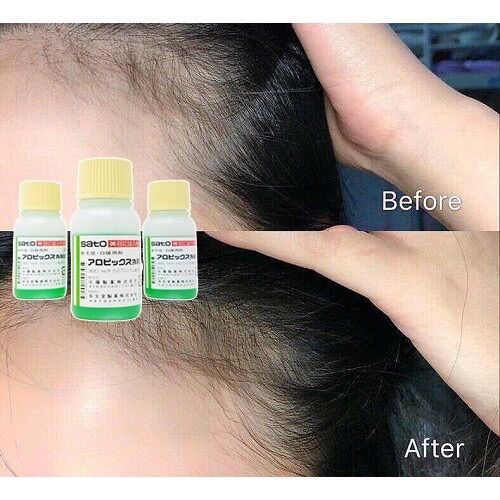 Tinh Chất Mọc Tóc Sato Nhật Bản 30ML