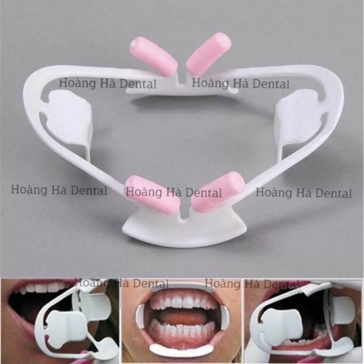 Banh miệng 3D dùng trong nha khoa
