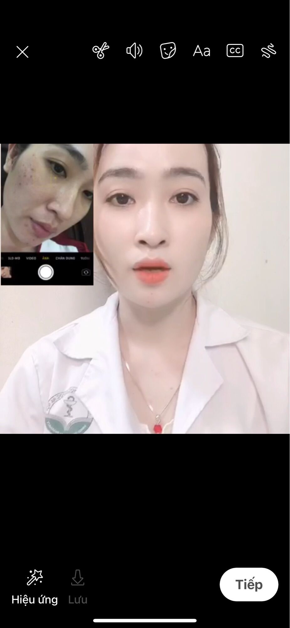 (Combo) Mờ NÁM CAO CẤP HUNA 1 L.TRÌNH HUNA